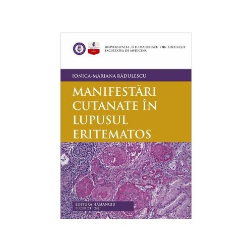 Manifestari cutanate in lupusul eritematos - Ionica-Mariana Radulescu