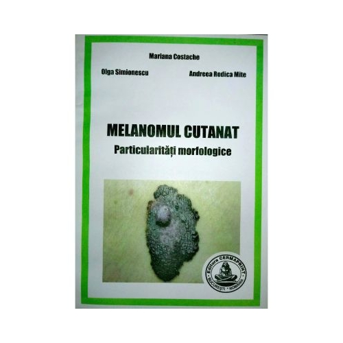 Melanomul cutanat. Particularitati morfologice - Mariana Costache