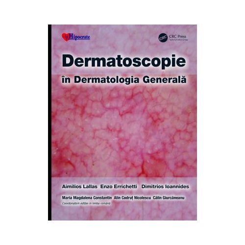 Dermatoscopie in Dermatologia Generala - Aimilios Lallas Enzo Errichetti Dimitrios Ioannides Calin Giurcaneanu Maria Magdalena Constantin Alin Codrut Nicolescu
