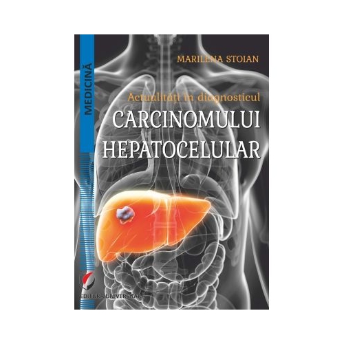 Actualitati in diagnosticul carcinomului hepatocelular - Marilena Stoian