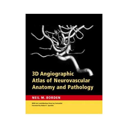 3D Angiographic Atlas of Neurovascular Anatomy and Pathology - Neil M. Borden MD