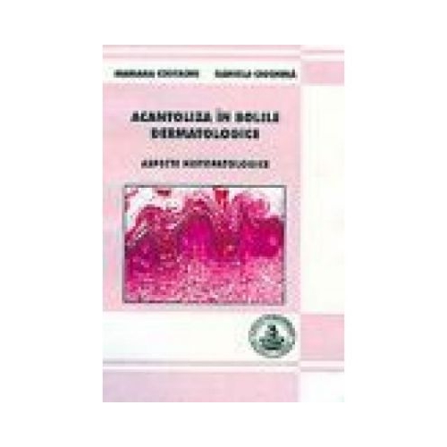Acantoliza in bolile dermatologice - Mariana Costache, Daniela Ciochina