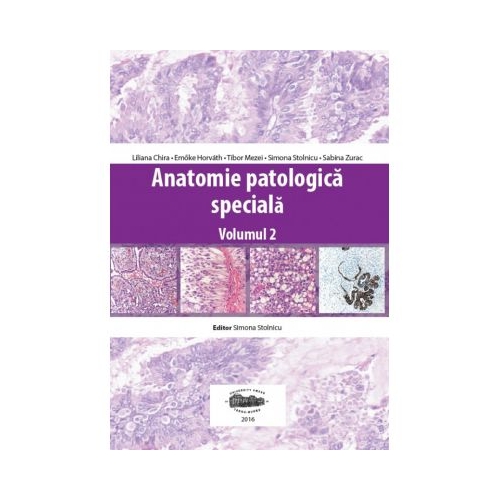 Anatomie patologica speciala, volumul II - Liliana Chira, Emoke Horvath, Tibor Mezei, Simona Stolnicu, Sabina Zurac