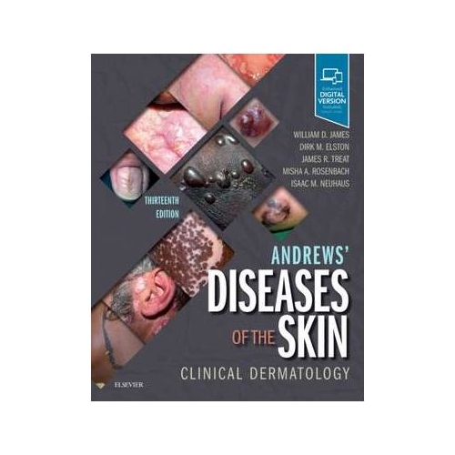 Andrews' Diseases of the Skin. Clinical Dermatology - William D. James, Dirk Elston, James R. Treat, Misha A. Rosenbach, Isaac Neuhaus