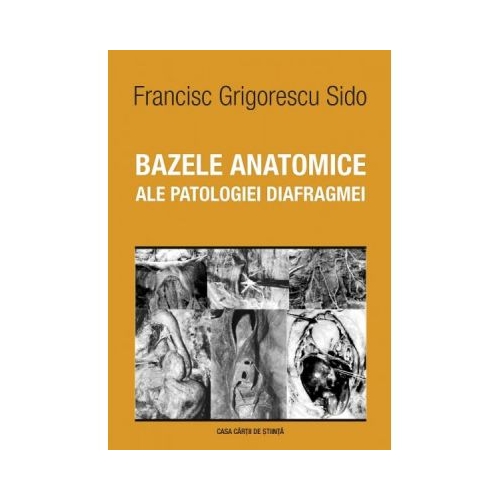 Hipertensiunea pulmonara. Istorii clinice surprinzatoare - Carmen Ginghina