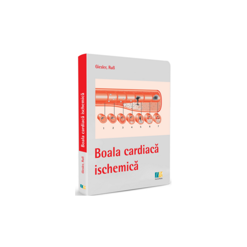 Boala cardiaca ischemica (Giesler Rub)