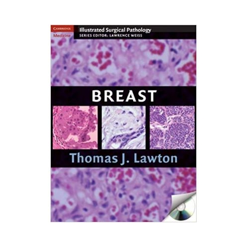 Breast - Thomas J. Lawton MD