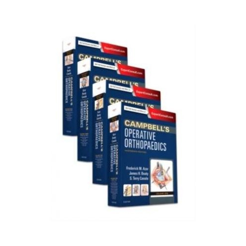 Campbell's Operative Orthopaedics, 4-Volume Set: Campbell Ortopedie - Frederick M Azar, S. Terry Canale, James H. Beaty