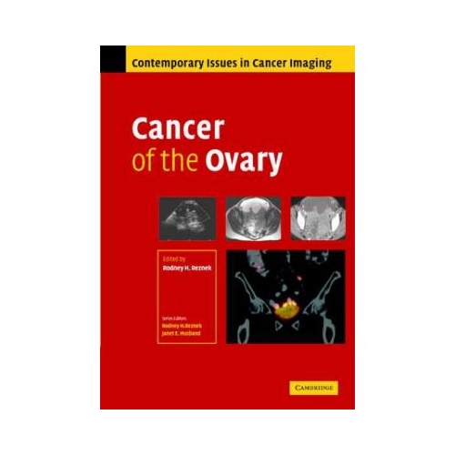 Cancer of the Ovary - Rodney Reznek