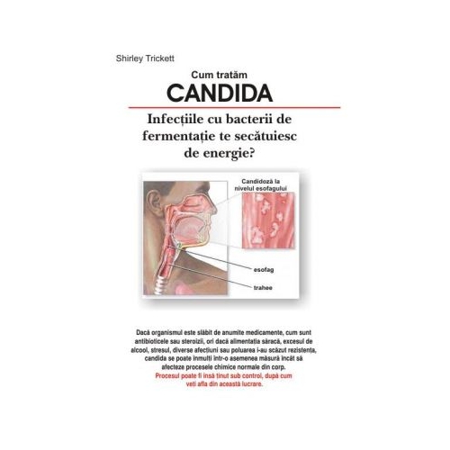 Candida - Shirley Trickett Obstretica si Ginecologie Antet