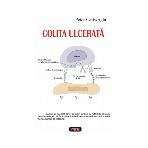 Colita ulcerata - Peter Cartwright