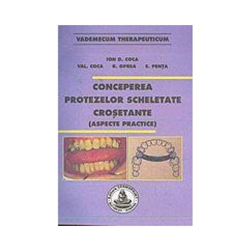 Conceperea protezelor scheletate crosetante