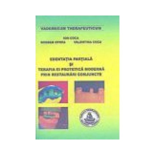 Edentatia partiala si terapia ei protetica moderna prin restaurari conjuncte (Ion Coca)