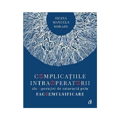 Complicatiile intraoperatorii ale operatiei de cataracta prin facoemulsificare - Dr. Ozana Moraru