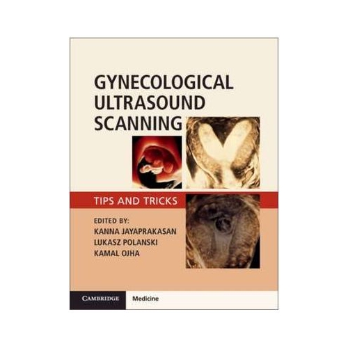 Gynaecological Ultrasound Scanning: Tips and Tricks - Kanna Jayaprakasan, Lukasz Polanski, Kamal Ojha