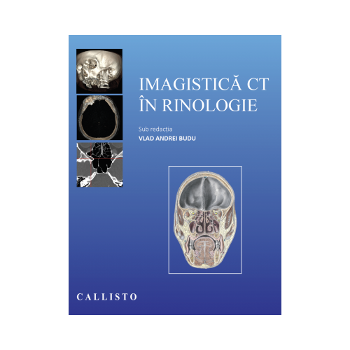 Imagistica CT in rinologie - Vlad Andrei Budu