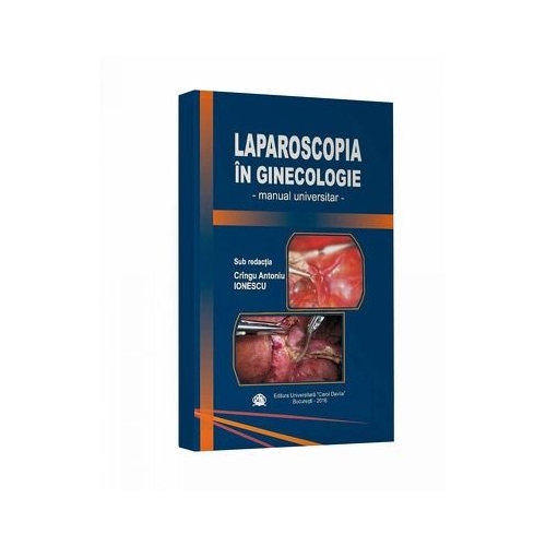 Laparoscopia in ginecologie. Manual universitar