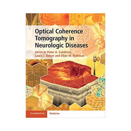 Optical Coherence Tomography in Neurologic Diseases - Peter A. Calabresi, Laura J. Balcer, Elliot M. Frohman