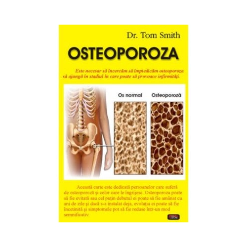 Osteoporoza - Dr. Tom Smith