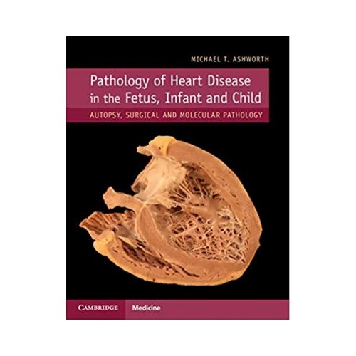 Pathology of Heart Disease in the Fetus, Infant and Child: Autopsy, Surgical and Molecular Pathology - Michael T. Ashworth