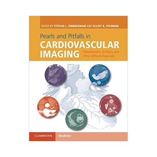 Pearls and Pitfalls in Cardiovascular Imaging: Pseudolesions, Artifacts, and Other Difficult Diagnoses - Stefan L. Zimmerman, Elliot K. Fishman
