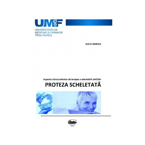 Proteza scheletata - Mircea Suciu