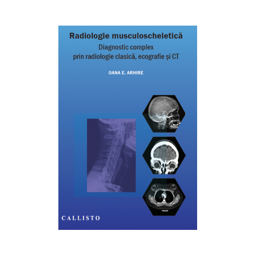 Radiologie musculo-scheletica, diagnostic complex prin radiologie clasica, ecografie si CT - Elena Oana Arhire