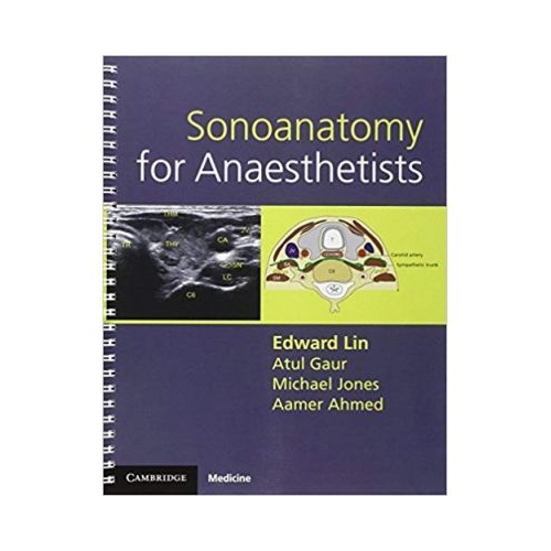 Sonoanatomy for Anaesthetists - Edward Lin, Atul Gaur, Michael Jones, Aamer Ahmed