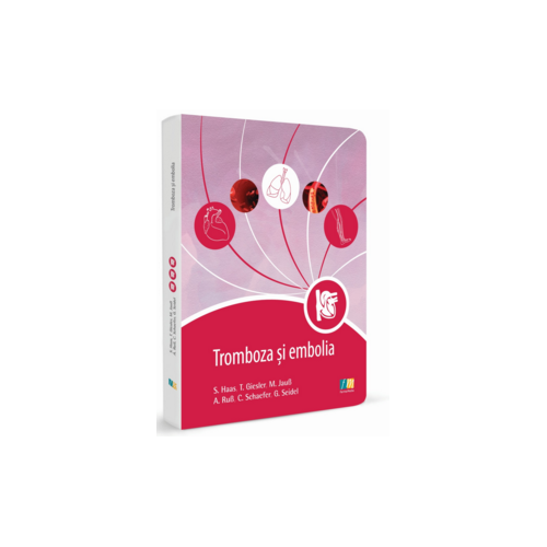 Tromboza si embolia
